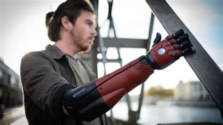 bionic arm