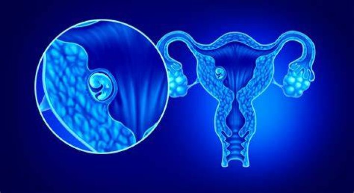Can you dislodge implanted embryo