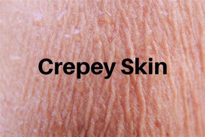 crepe skin