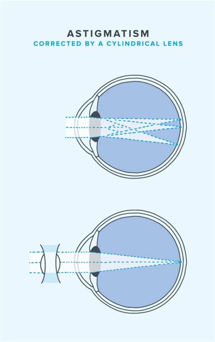 Slumped Contacts - How To Discuss